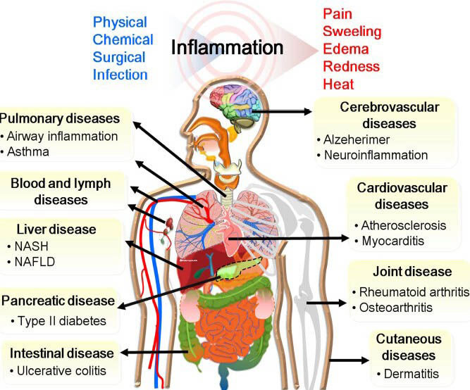 Systemic Inflammation